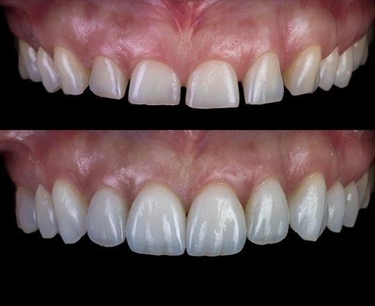 Dentística