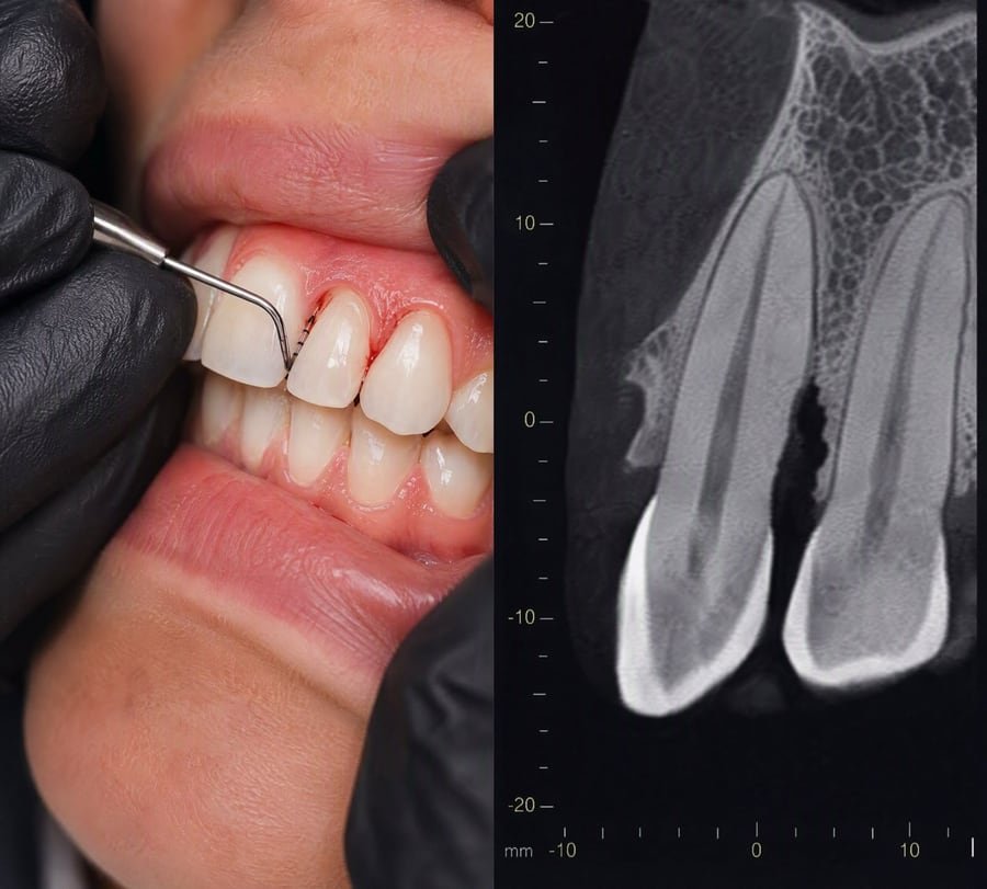 Periodontia